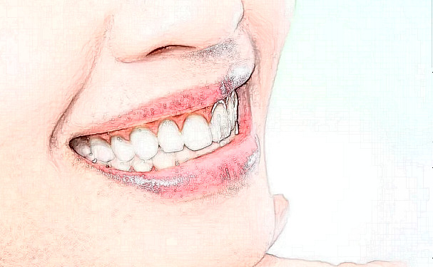 南京市第二醫院口腔科牙齒根管治療怎么樣?手術價格多少?案例一覽
