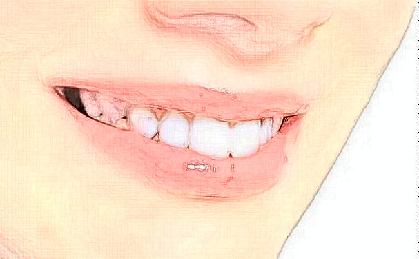 長治市人民醫(yī)院口腔科補(bǔ)牙費(fèi)用多少+真人術(shù)后點(diǎn)評(píng)
